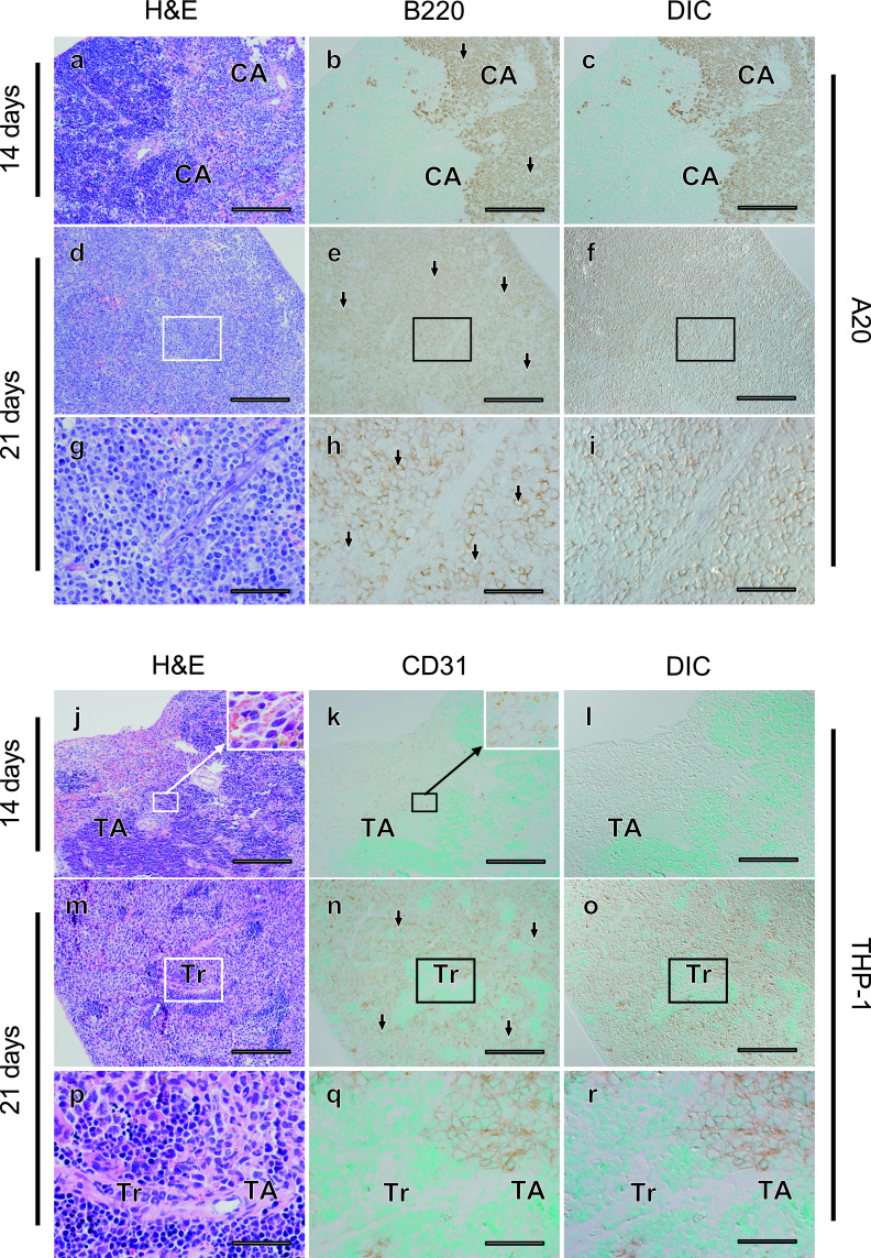 Differential Localization and Invasion of Tumor Cells in Mouse Models of Human and Murine Leukemias.