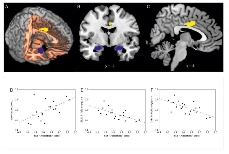 The impact of the digital revolution  on human brain and behavior: where  do we stand? .