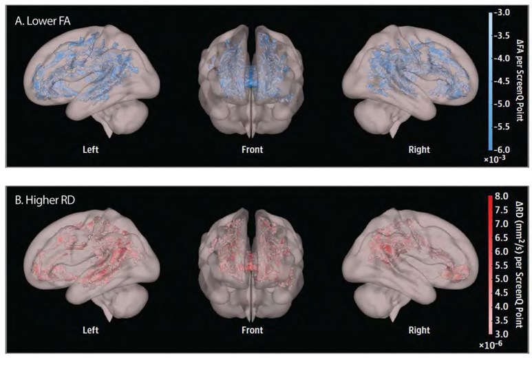 The impact of the digital revolution  on human brain and behavior: where  do we stand? .