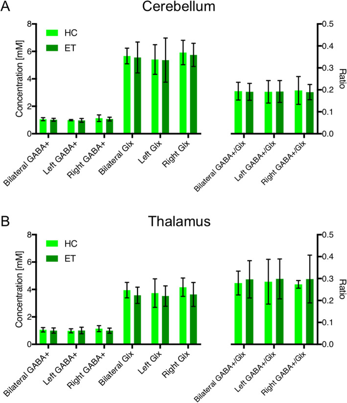 A pilot study of essential tremor: cerebellar GABA+/Glx ratio is correlated with tremor severity.