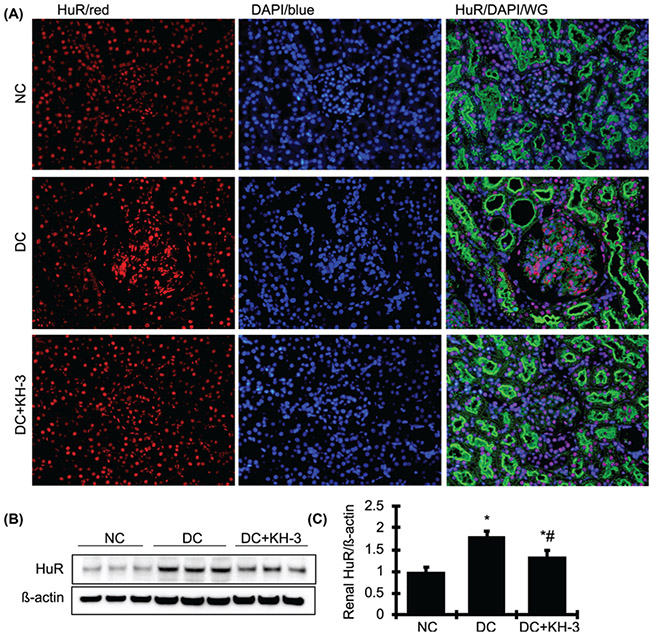 Inhibition of RNA-binding protein HuR reduces glomerulosclerosis in experimental nephritis.