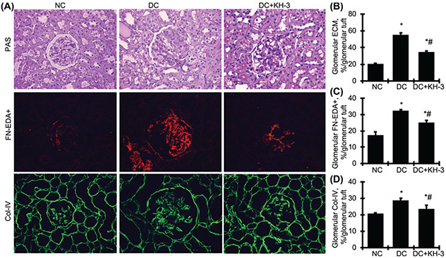 Inhibition of RNA-binding protein HuR reduces glomerulosclerosis in experimental nephritis.