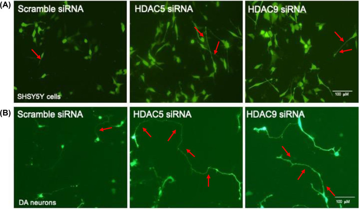 The class II histone deacetylases as therapeutic targets for Parkinson's disease.