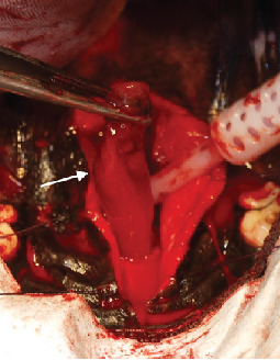 Nasopharyngeal Vascular Hamartoma in a Dog.