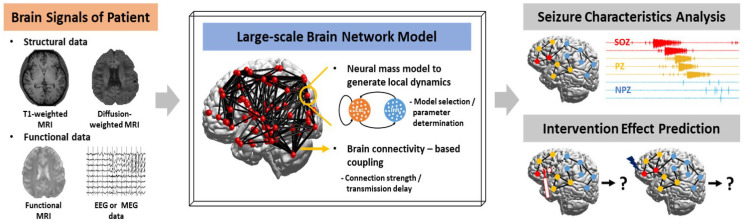 Artificial Intelligence and Computational Approaches for Epilepsy.