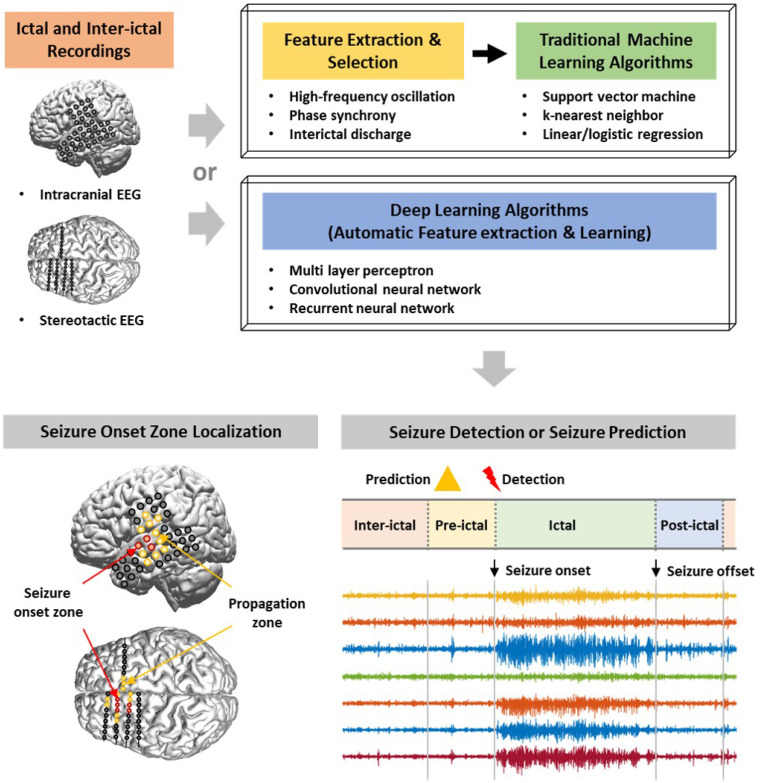 Artificial Intelligence and Computational Approaches for Epilepsy.