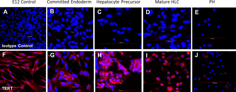 In vitro Differentiation of Human TERT-Transfected Multi-Lineage Progenitor Cells (MLPC) into Immortalized Hepatocyte-Like Cells.