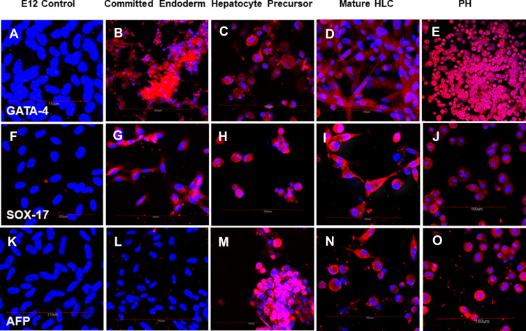 In vitro Differentiation of Human TERT-Transfected Multi-Lineage Progenitor Cells (MLPC) into Immortalized Hepatocyte-Like Cells.