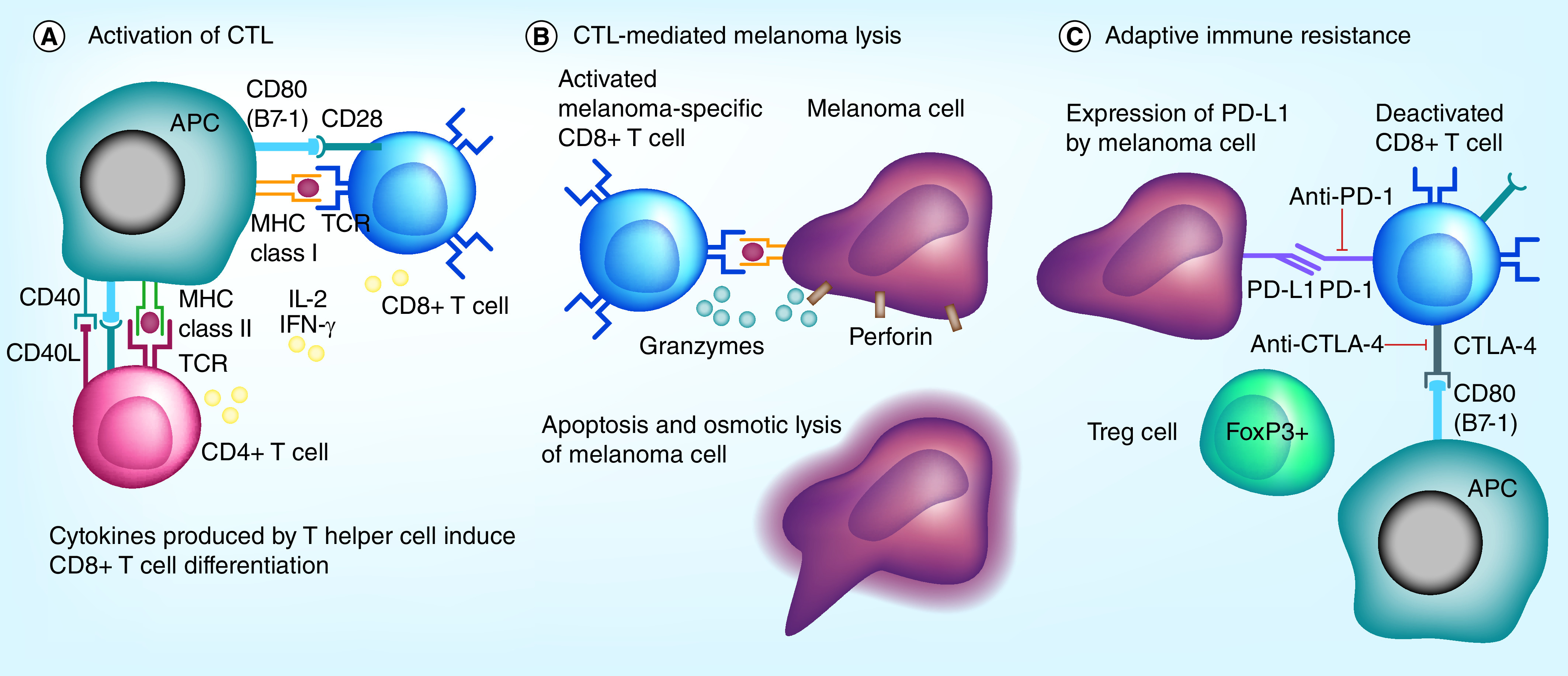 Melanoma brain metastases: review of histopathological features and immune-molecular aspects.