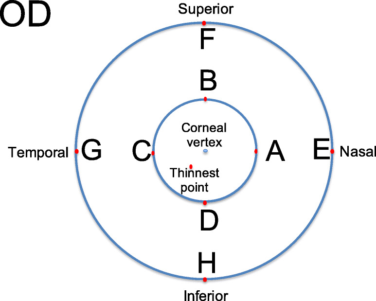 The precision and agreement of corneal thickness and keratometry measurements with SS-OCT versus Scheimpflug imaging.