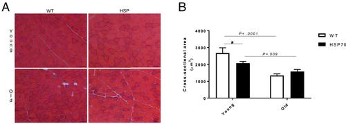 Overexpression of HSP70 attenuates sarcopenia by suppressing the expression of miR-133b