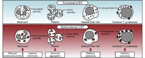 Chediak-Higashi syndrome: A review of the past, present, and future