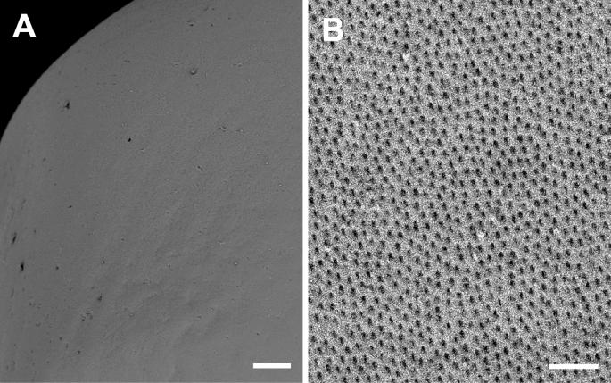 Ultrastructure of the fertilized egg envelopes in Ancistrus cirrhosus, Loricariidae, Teleostei