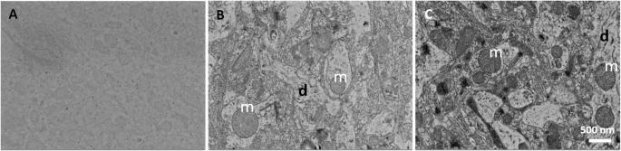 Double staining method for array tomography using scanning electron microscopy