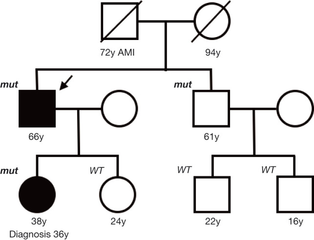 A Case of Metastatic Hereditary Leiomyomatosis and Renal Cell Cancer Syndrome-Associated Renal Cell Carcinoma Treated with a Sequence of Axitinib and Nivolumab Following Cytoreductive Nephrectomy.