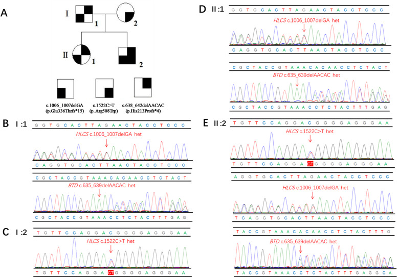 Clinical, biochemical, and genetic analysis of a Chinese Han pedigree with holocarboxylase synthetase deficiency: a case report.