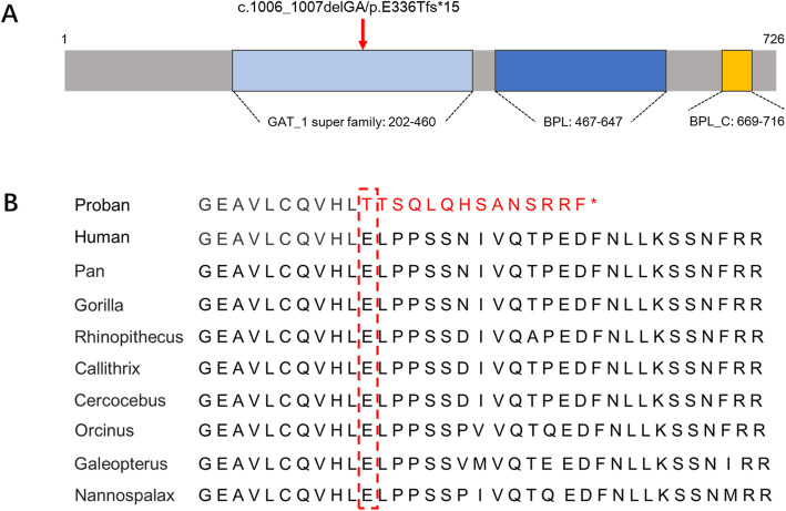 Clinical, biochemical, and genetic analysis of a Chinese Han pedigree with holocarboxylase synthetase deficiency: a case report.