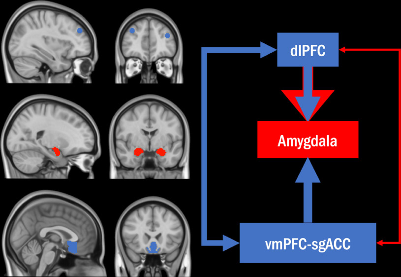 Posttraumatic stress symptomatology and abnormal neural responding during emotion regulation under cognitive demands: mediating effects of personality.