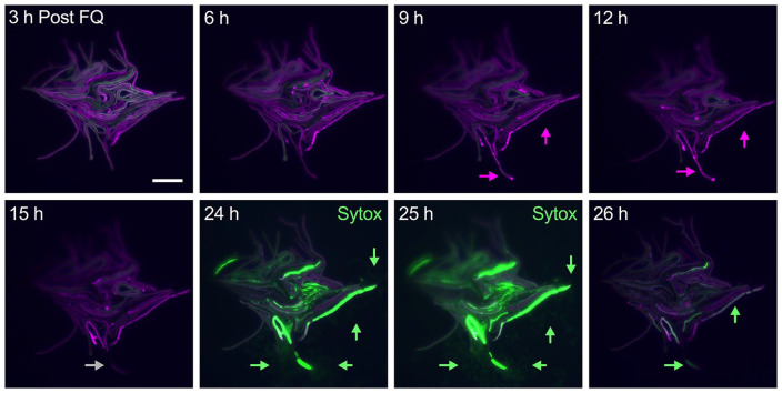 Delving Into the Functional Meaning of Phenotypic Variation in Mycobacterial Persistence: Who Benefits the Most From Programmed Death of Individual Cells?