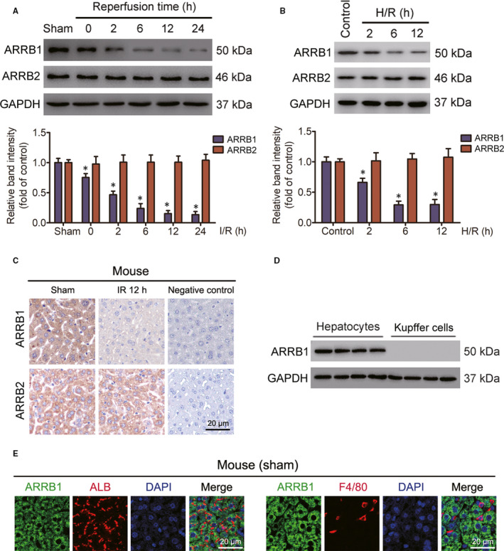 ARRB1 ameliorates liver ischaemia/reperfusion injury via antagonizing TRAF6-mediated Lysine 6-linked polyubiquitination of ASK1 in hepatocytes.