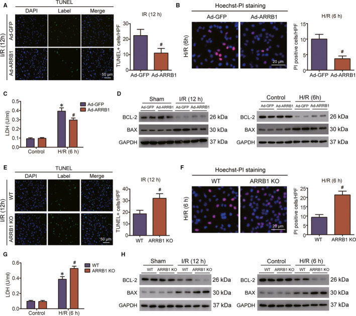 ARRB1 ameliorates liver ischaemia/reperfusion injury via antagonizing TRAF6-mediated Lysine 6-linked polyubiquitination of ASK1 in hepatocytes.