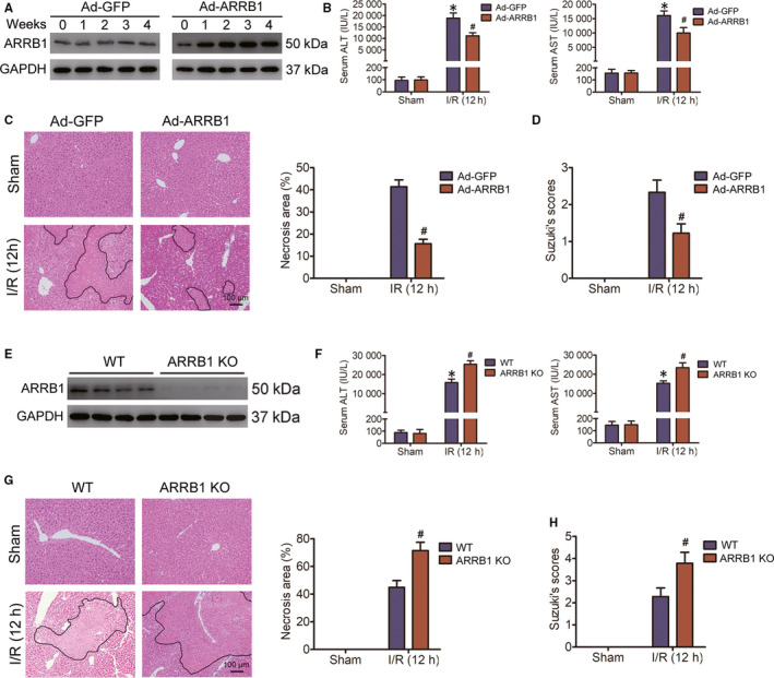 ARRB1 ameliorates liver ischaemia/reperfusion injury via antagonizing TRAF6-mediated Lysine 6-linked polyubiquitination of ASK1 in hepatocytes.