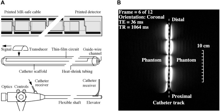 In Vitro Intraductal MRI and T2 Mapping of Cholangiocarcinoma Using Catheter Coils.