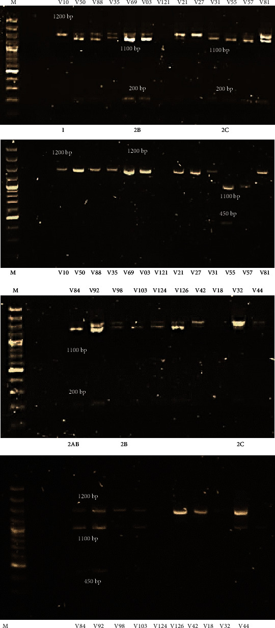 Prevalence of Genotypes and Subtypes of <i>Gardnerella vaginalis</i> in South African Pregnant Women.