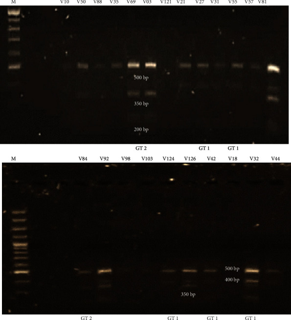 Prevalence of Genotypes and Subtypes of <i>Gardnerella vaginalis</i> in South African Pregnant Women.