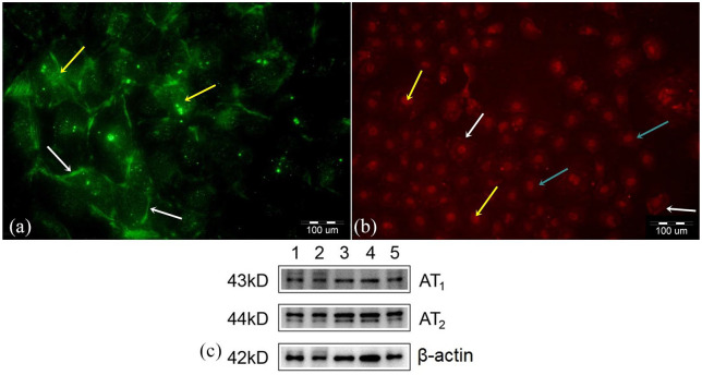 Influence of Angiotensin II on cell viability and apoptosis in rat renal proximal tubular epithelial cells in in vitro studies.