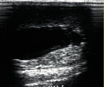 Bilateral Intratesticular Spermatoceles in a Critically Endangered Dama Gazelle (<i>Nanger dama mhorr</i>).