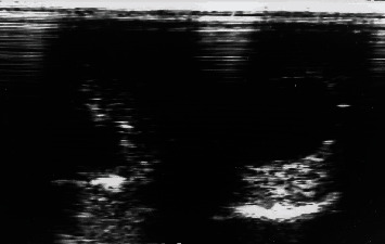 Bilateral Intratesticular Spermatoceles in a Critically Endangered Dama Gazelle (<i>Nanger dama mhorr</i>).