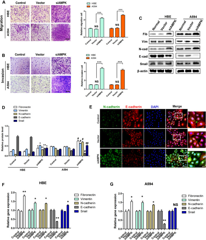 Low levels of AMPK promote epithelial-mesenchymal transition in lung cancer primarily through HDAC4- and HDAC5-mediated metabolic reprogramming.