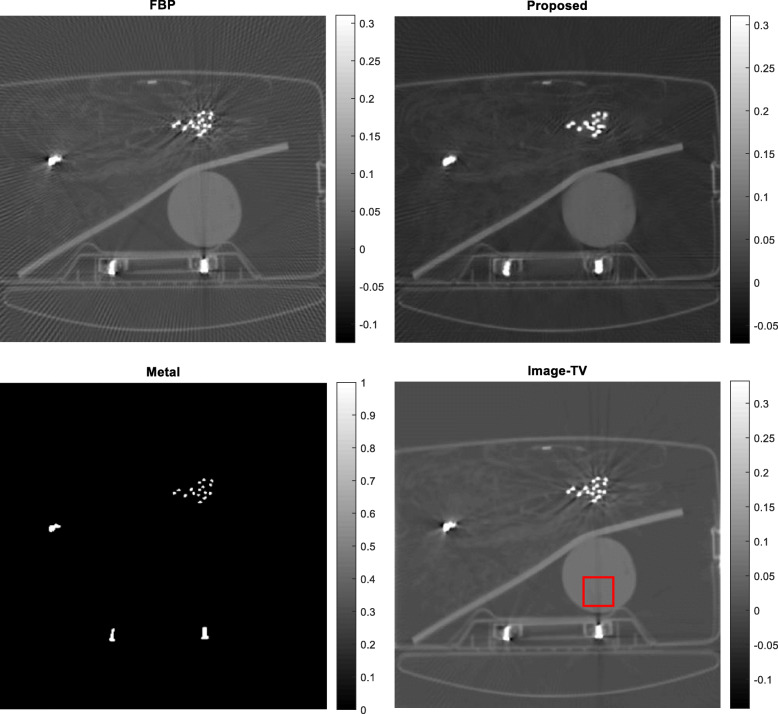 Projection-domain iteration to estimate unreliable measurements.