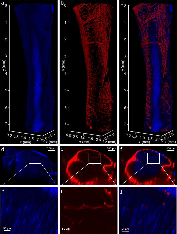 Bimodal Whole-Mount Imaging of Tendon Using Confocal Microscopy and X-ray Micro-Computed Tomography.