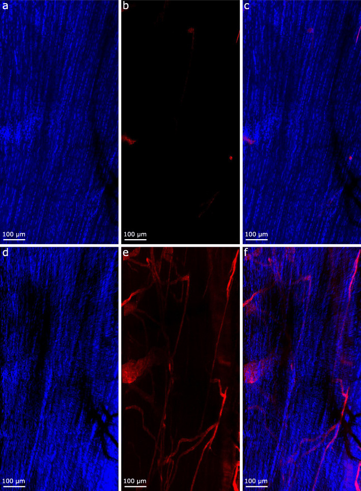 Bimodal Whole-Mount Imaging of Tendon Using Confocal Microscopy and X-ray Micro-Computed Tomography.