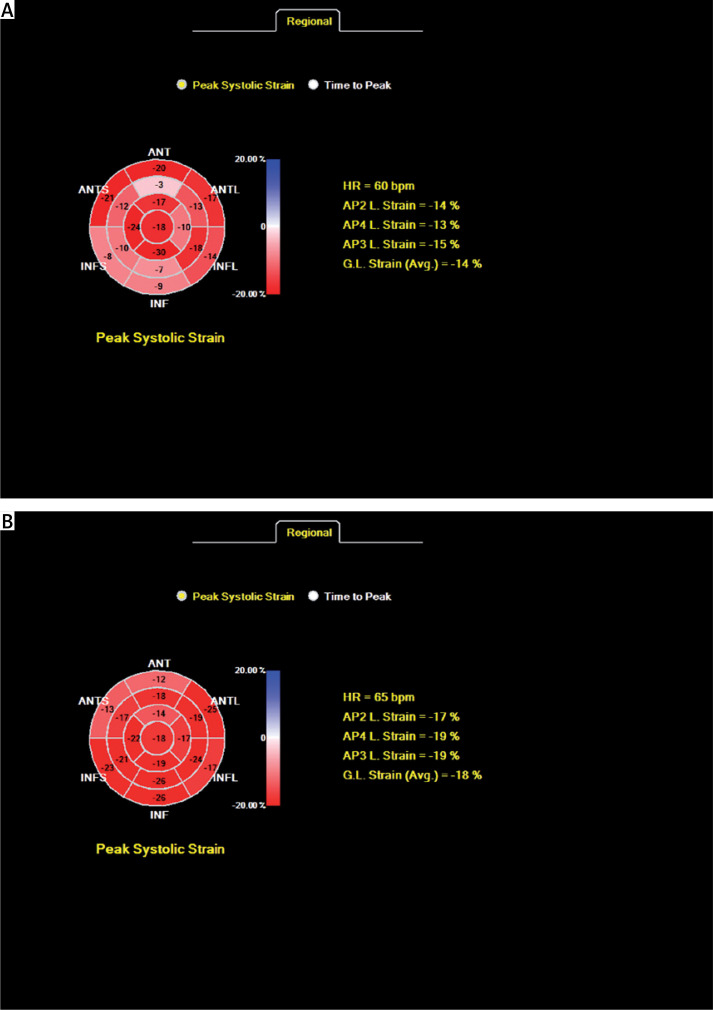 Silent myocardial dysfunction in vitamin D deficiency.