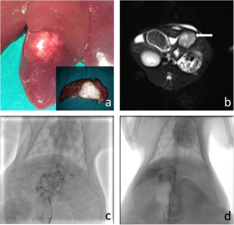 Expression of MMP-2 in residual VX2 liver tumor after transcatheter arterial embolization combined with portal venous embolization in an animal model