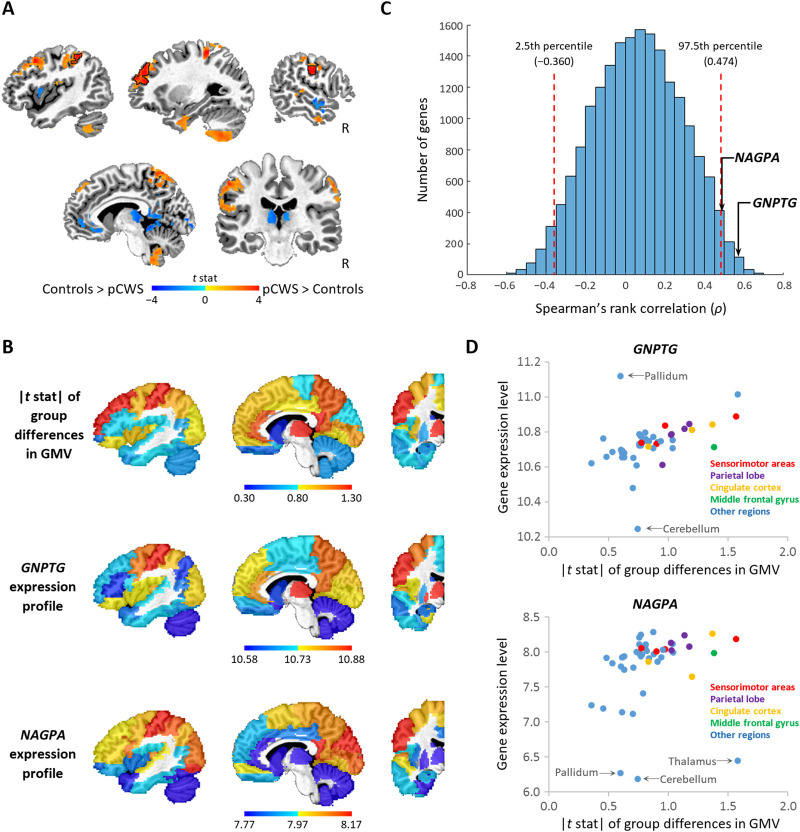 Linking Lysosomal Enzyme Targeting Genes and Energy Metabolism with Altered Gray Matter Volume in Children with Persistent Stuttering.