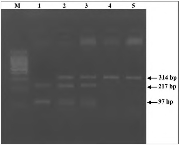 Implication of <i>VDR</i> Rs7975232 and <i>FCGR2A</i> Rs1801274 Gene Polymorphisms in the Risk and the Prognosis of autoimmune Thyroid Diseases in the Tunisian Population.