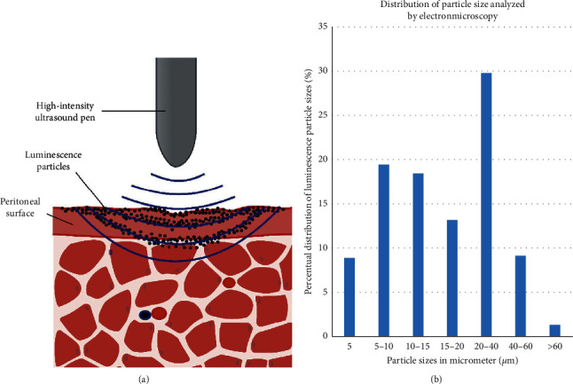 Enabling Microparticle Imprinting to Achieve Penetration and Local Endurance in the Peritoneum via High-Intensity Ultrasound (HIUS) for the Treatment of Peritoneal Metastasis.