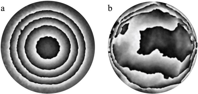 An interferometric ex vivo study of corneal biomechanics under physiologically representative loading, highlighting the role of the limbus in pressure compensation.