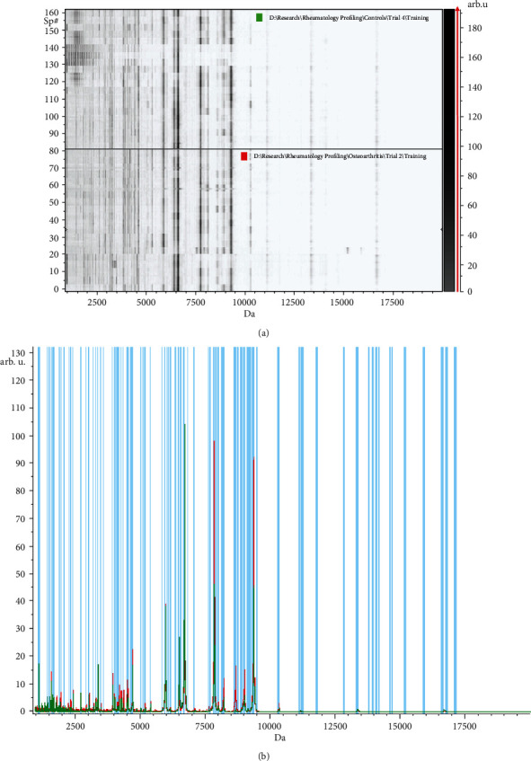 Serum Peptidomic Profile as a Novel Biomarker for Rheumatoid Arthritis.