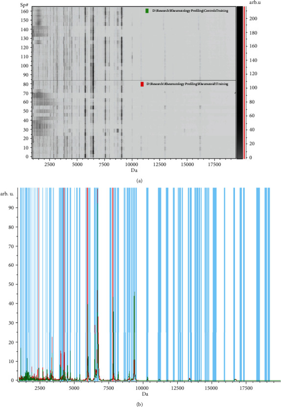 Serum Peptidomic Profile as a Novel Biomarker for Rheumatoid Arthritis.