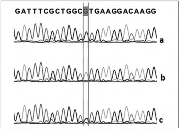 An Investigation of the <i>COMT</i> Gene Val158Met Polymorphism in Patients Admitted to the Emergency Department Because of Synthetic Cannabinoid Use.