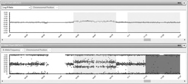 A Very Rare Partial Trisomy Syndrome: <i>De Novo</i> Duplication of 16q12.1q23.3 in a Turkish Girl with Developmental Delay and Facial Dysmorphic Features.