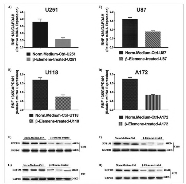 β-Elemene Inhibits the Proliferation and Migration of Human Glioblastoma Cell Lines <i>via</i> Suppressing Ring Finger Protein 135.