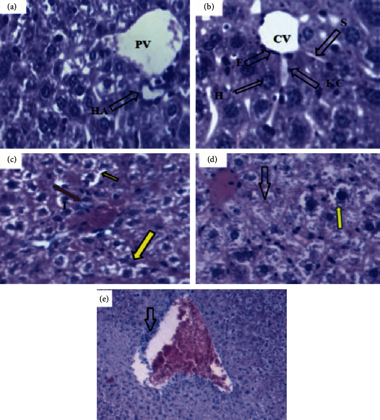 Subacute Hepatotoxicity of Extracts of <i>Senna occidentalis</i> Seeds in Swiss Albino Mice.