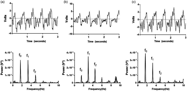 A brief report on the effects of vasoactive agents on peripheral venous waveforms in a porcine model.