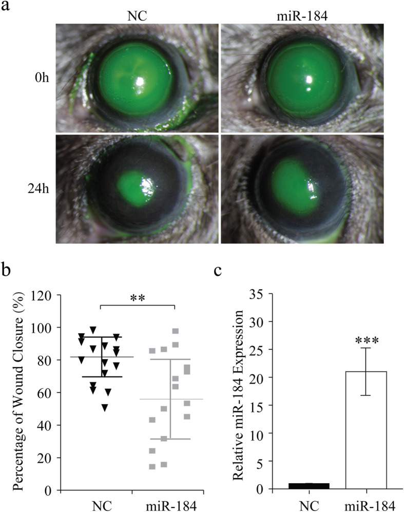 MicroRNA-184 negatively regulates corneal epithelial wound healing via targeting <i>CDC25A</i>, <i>CARM1</i>, and <i>LASP1</i>.